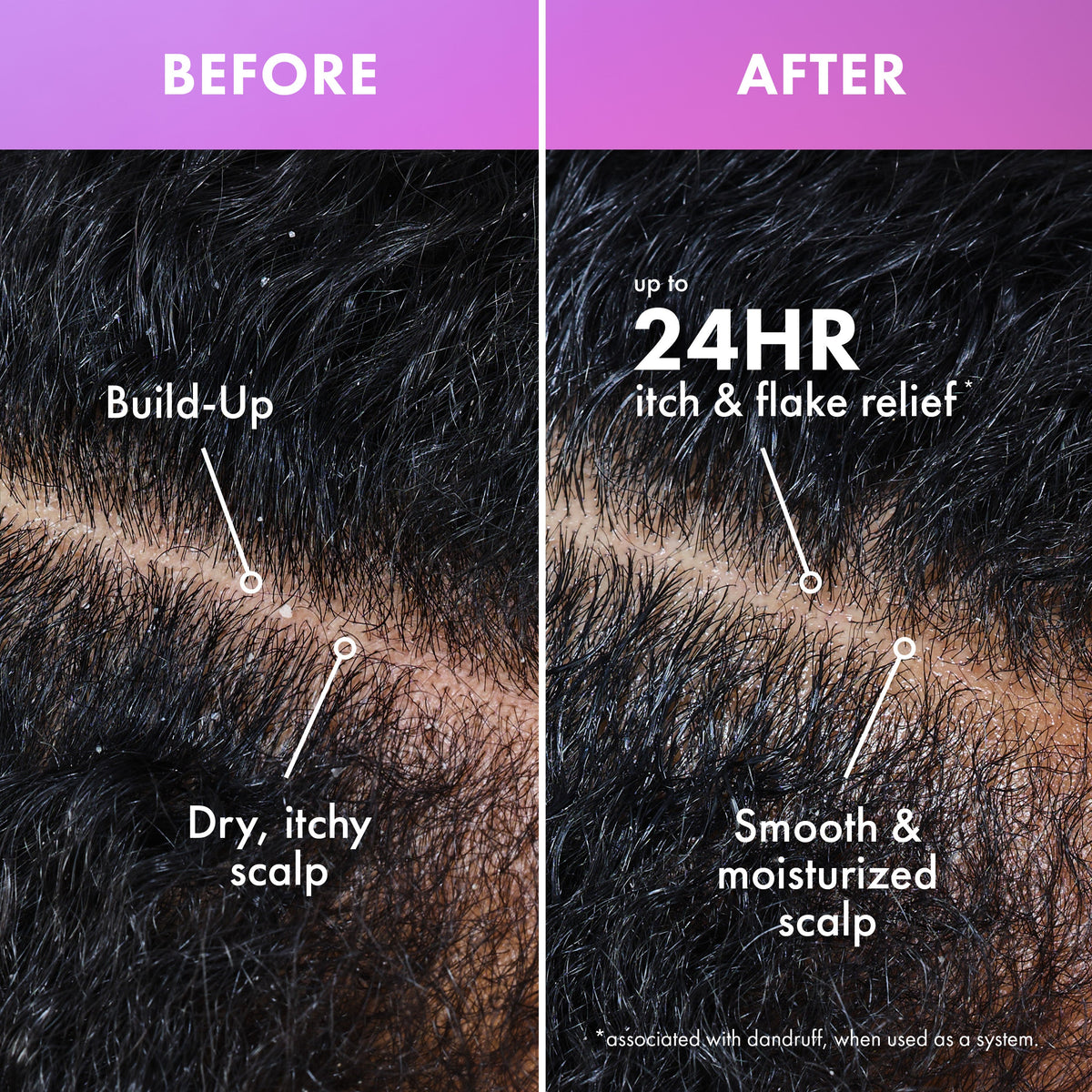 Lavender & Lychee Scalp Moisturizing Shampoo